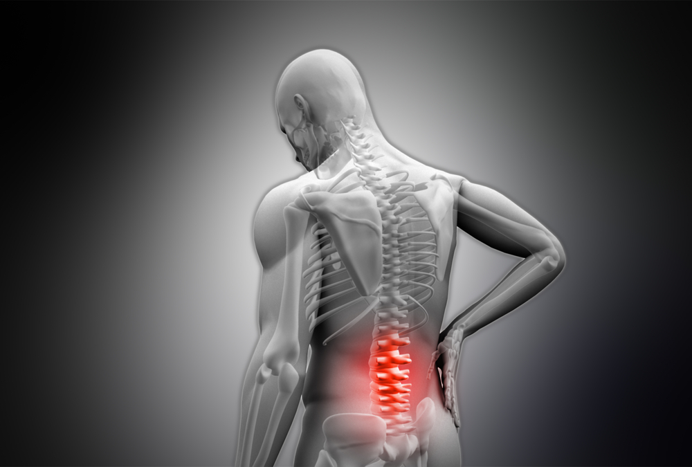 What are common back injuries?